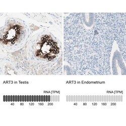 ART3 Antibody, Novus Biologicals:Antibodies:Primary Antibodies